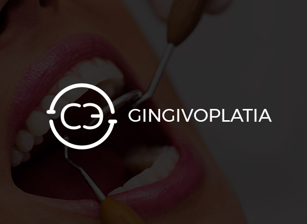 Gingivoplastia